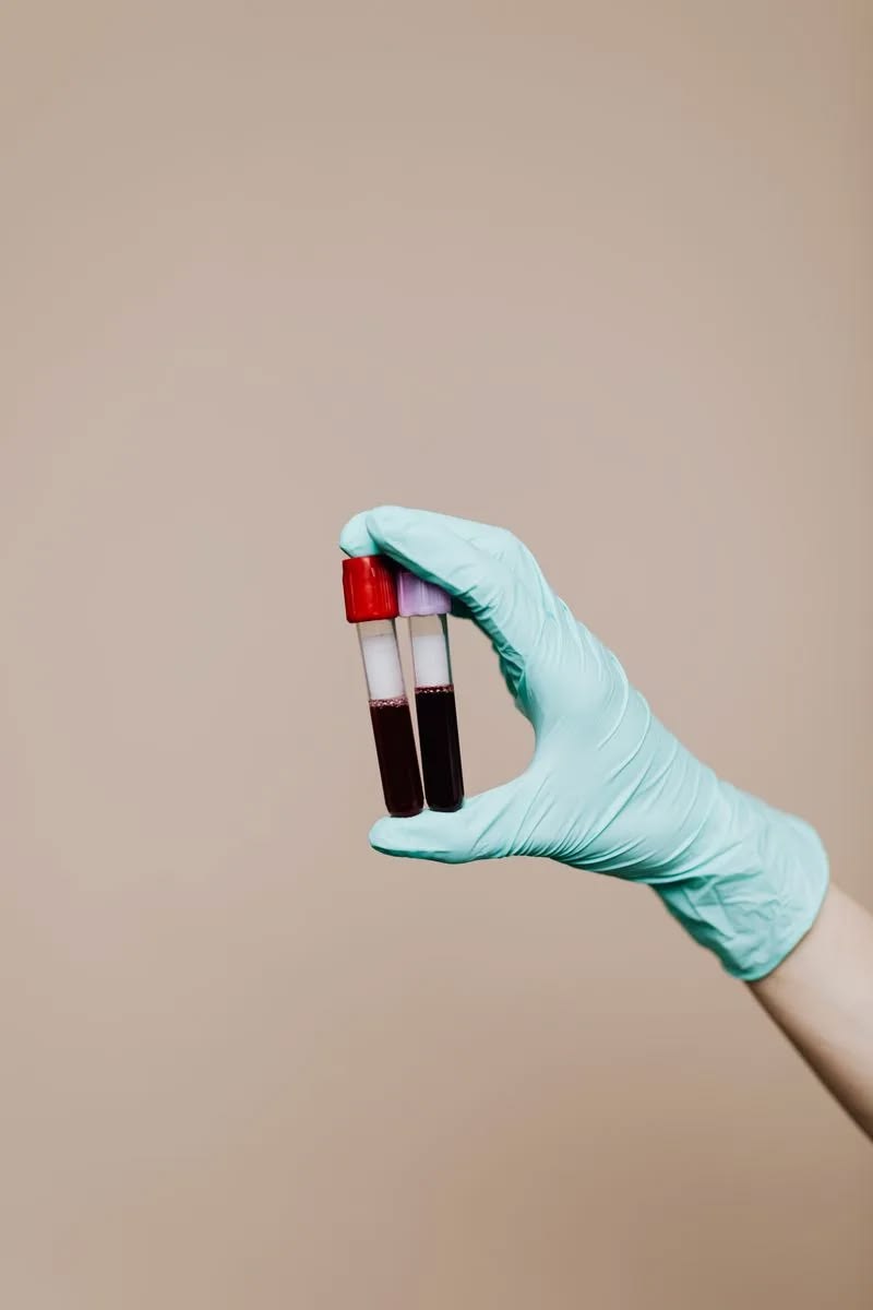 A gloved hand holding two blood sample tubes