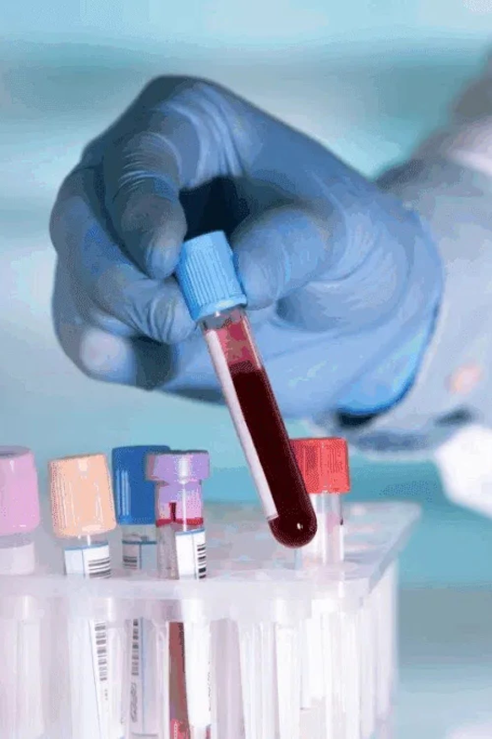 Próbka krwi umieszczana w stojaku laboratoryjnym